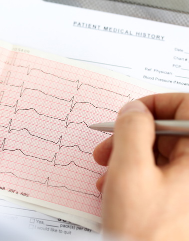 Il defibrillatore impiantabile migliora la sopravvivenza nella cardiomiopatia ischemica o non